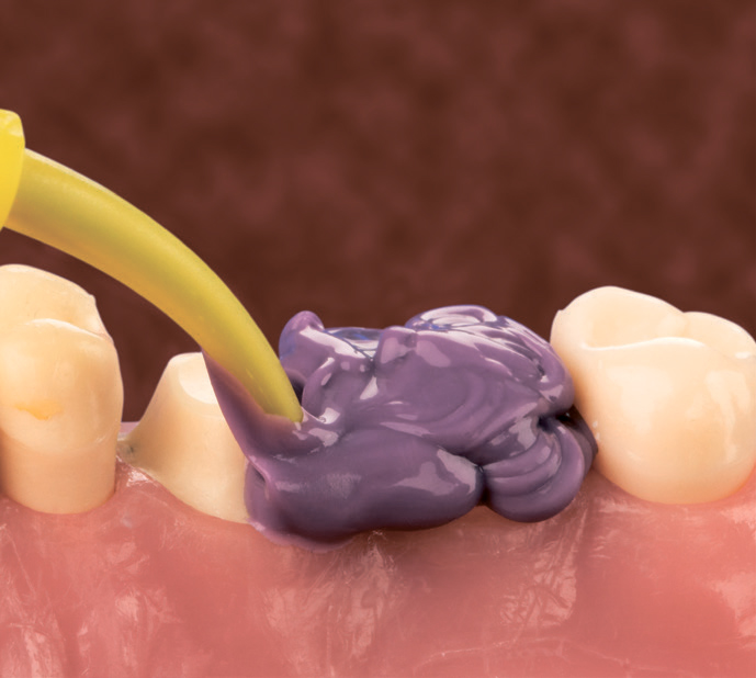 Силагум Медиум - внесение